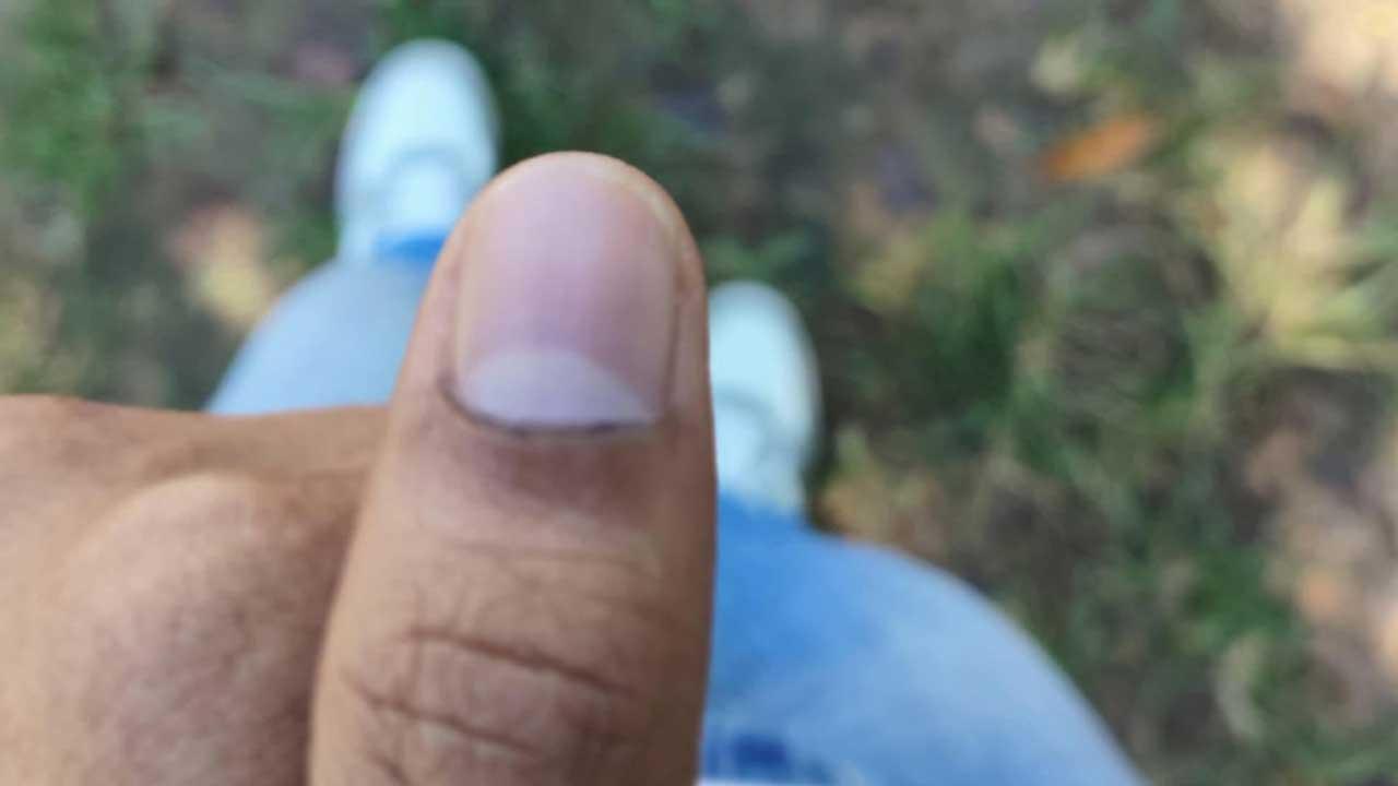 চাকসু নির্বাচন: ভোটের কালি মুছে যাচ্ছে, অভিযোগ দেবে ছাত্রদল