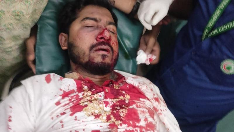 আ. লীগ নিষিদ্ধের দাবিতে গণঅধিকার পরিষদের বিক্ষোভ, হামলায় রক্তাক্ত নুরুল হক